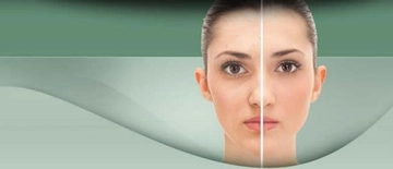 Elma Sirkesi Yüz Maskesi Tarifi ve Malzemeleri